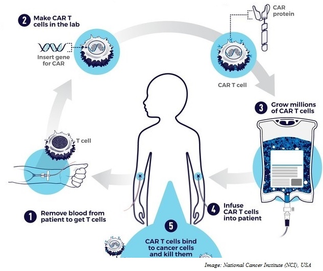 CAR-T, Cell therapy